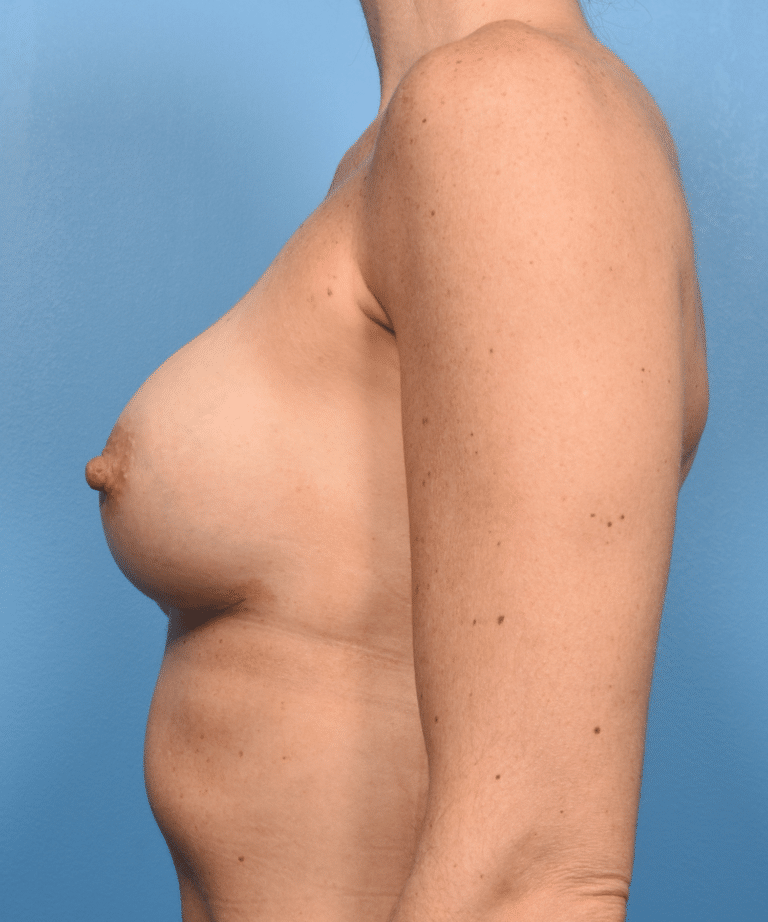 After Image