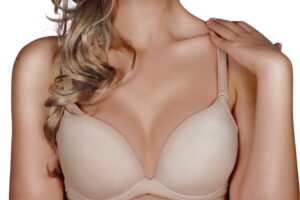 Woman representing natural-looking Preservé™ breast augmentation results.