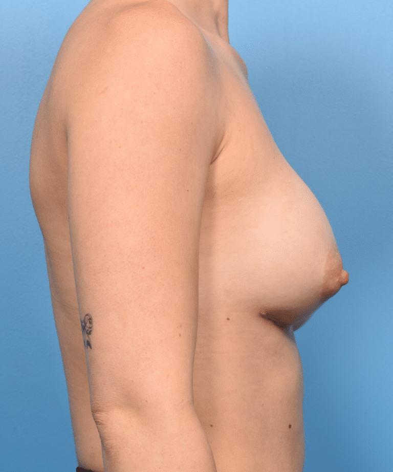 After Image