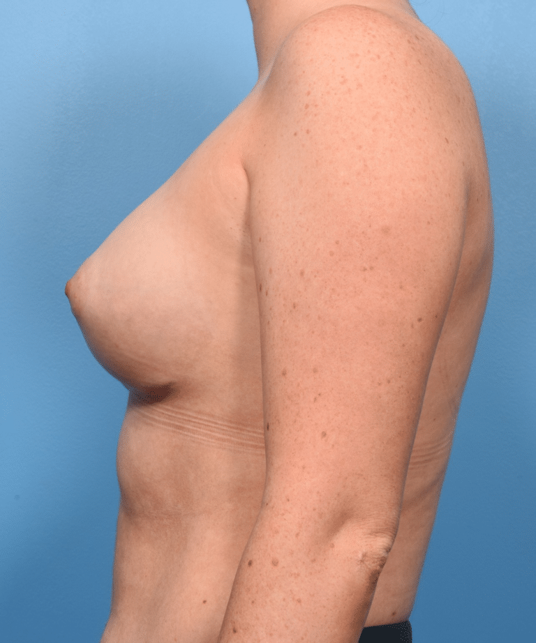 After Image
