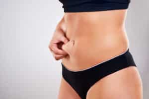 Woman showing flatter abdomen after tummy tuck surgery